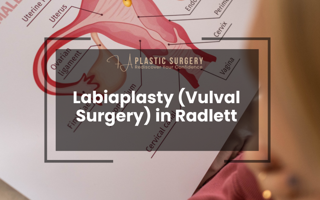 Labiaplasty (Vulval Surgery) in Radlett