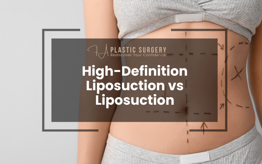 High-Definition Liposuction vs Liposuction