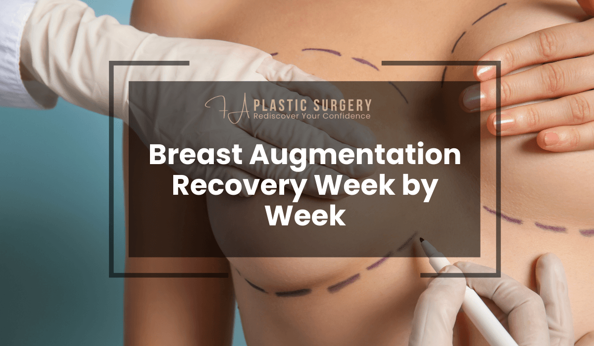 Breast Augmentation Recovery Week by Week