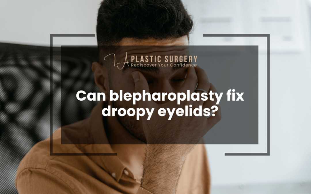 Can blepharoplasty fix droopy eyelids