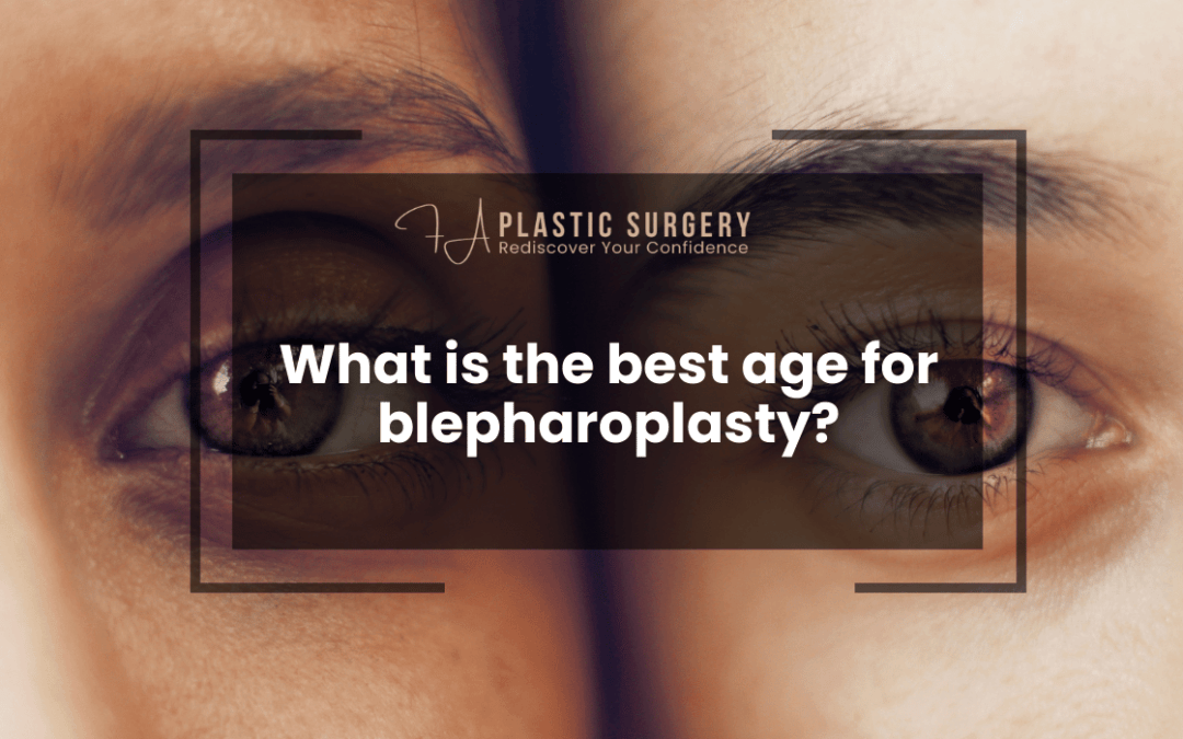 What is the best age for blepharoplasty?