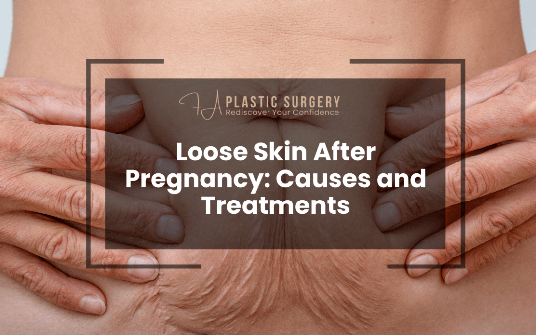 Loose Skin After Pregnancy Causes and Treatments